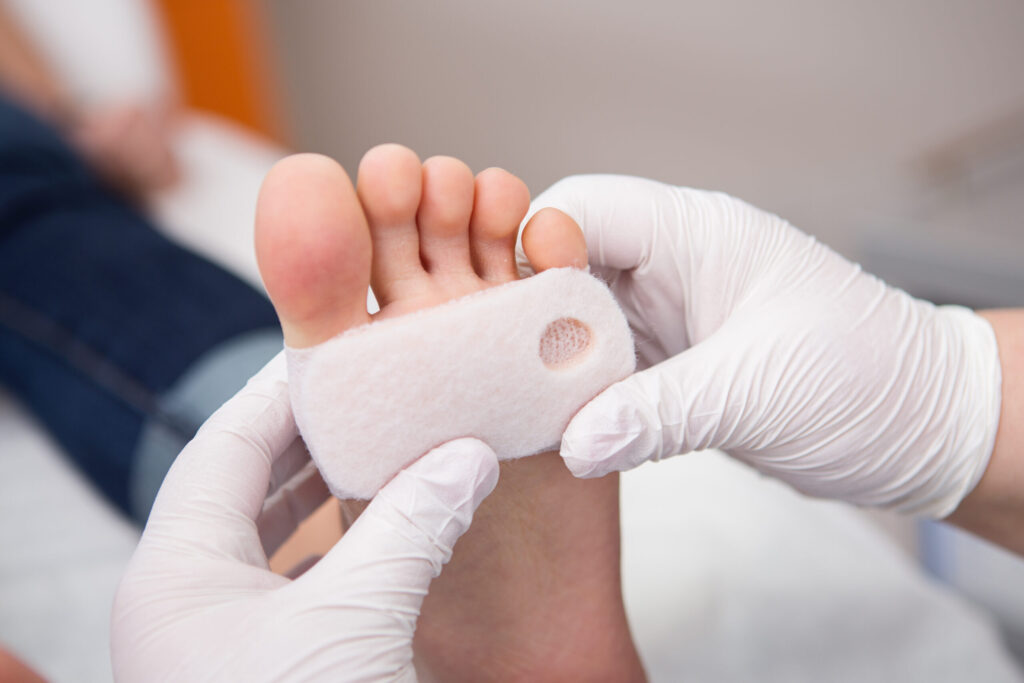 Exploring the Connection Between a Podiatrist and Athletic Performance