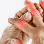 The Benefits of Regenerative Orthopedics for Cartilage Repair