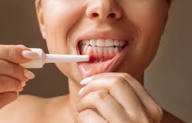 The Connection Between Gum Disease and Overall Health