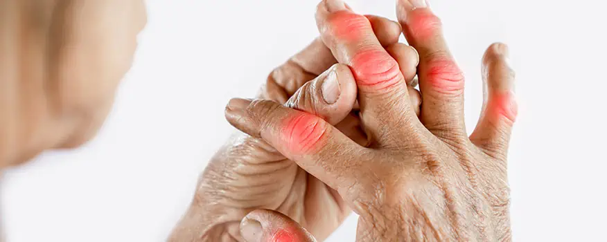 Understanding the Types, Symptoms and Treatments of Arthritis