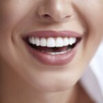 Enhancing Your Smile with Porcelain Veneers