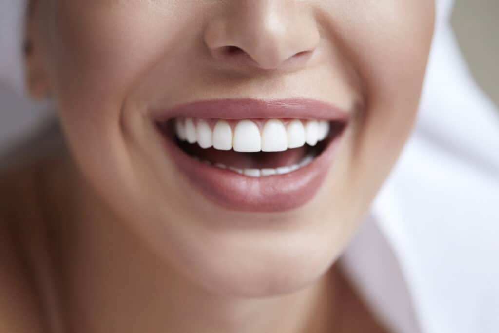 Enhancing Your Smile with Porcelain Veneers