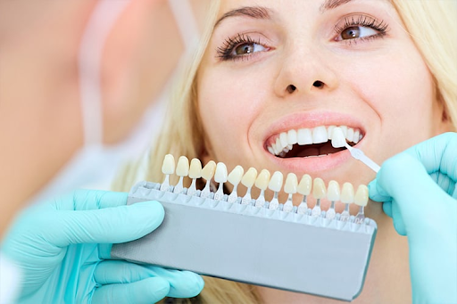Exploring the Benefits of Dental Implants for Long-Term Oral Health