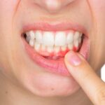 Understanding Gum Disease and How a Family Dentist Can Help