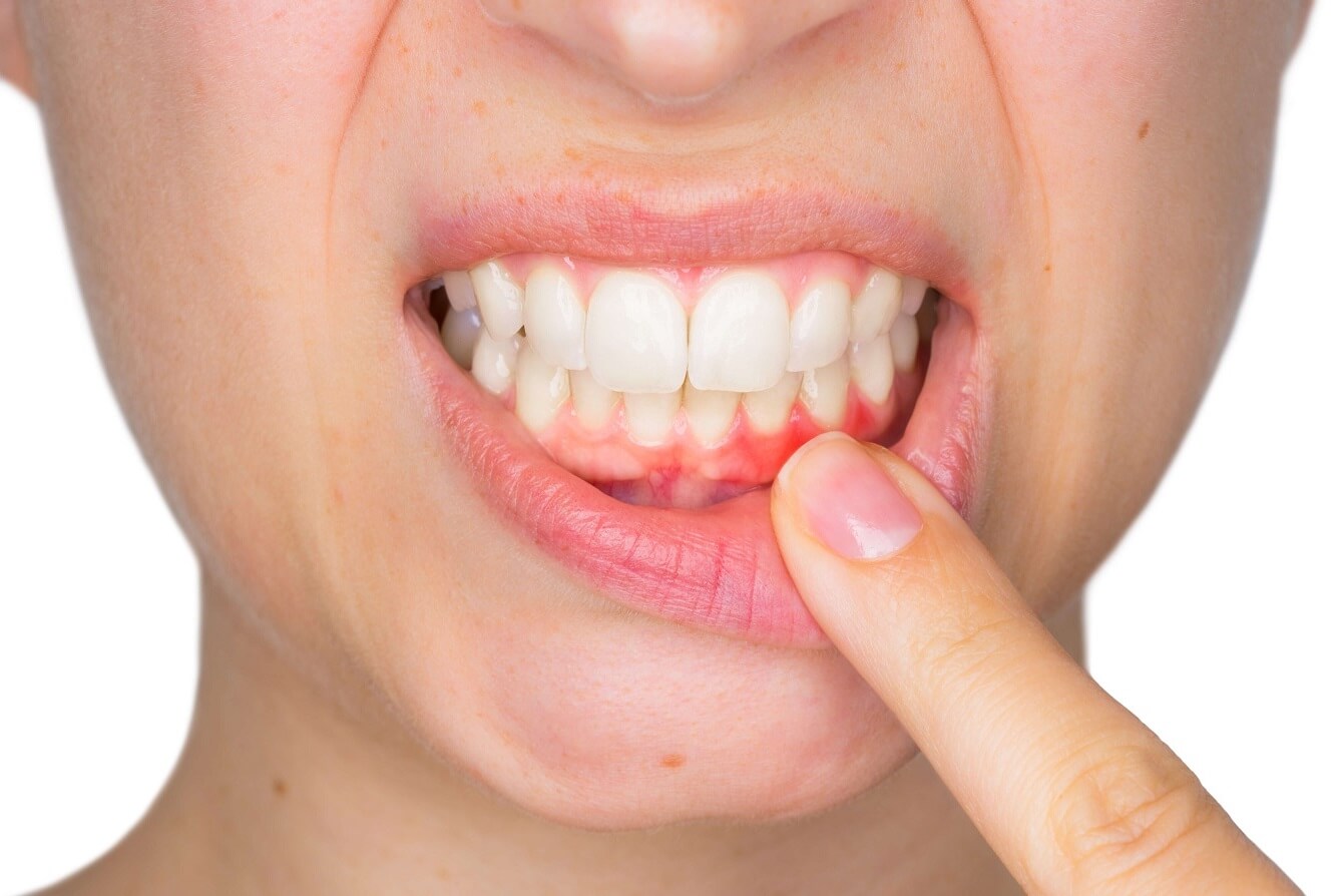 Understanding Gum Disease and How a Family Dentist Can Help