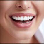 What to Expect From a Cosmetic Dentist Consultation