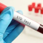 How To Know You Need an STD Screening