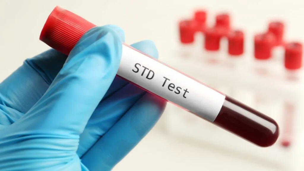 How To Know You Need an STD Screening