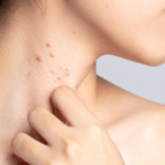 How to Maintain Healthy Skin Between Visits to Your Dermatologist