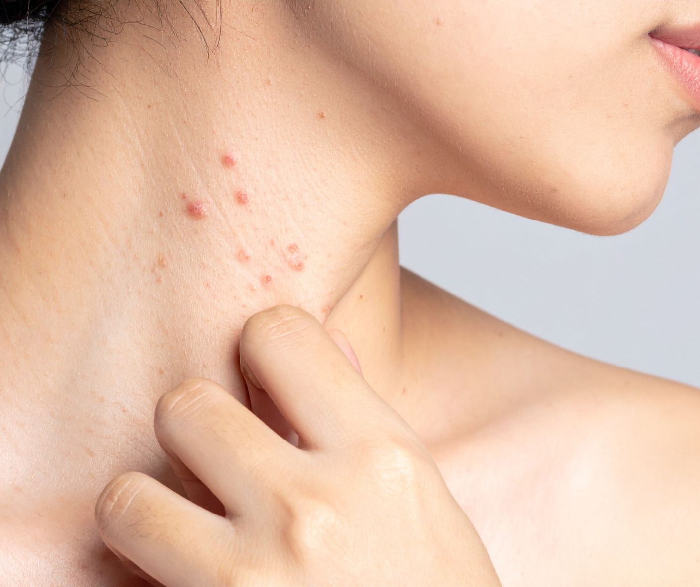 How to Maintain Healthy Skin Between Visits to Your Dermatologist