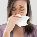 Nasal Congestion: Common Causes and How to Address Them