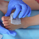 New Techniques in Wound Care Treatment