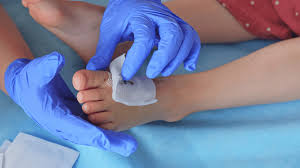 New Techniques in Wound Care Treatment