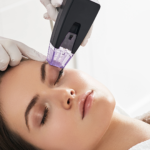 Exploring the Benefits of Radio Frequency Ablation for Chronic Pain Management