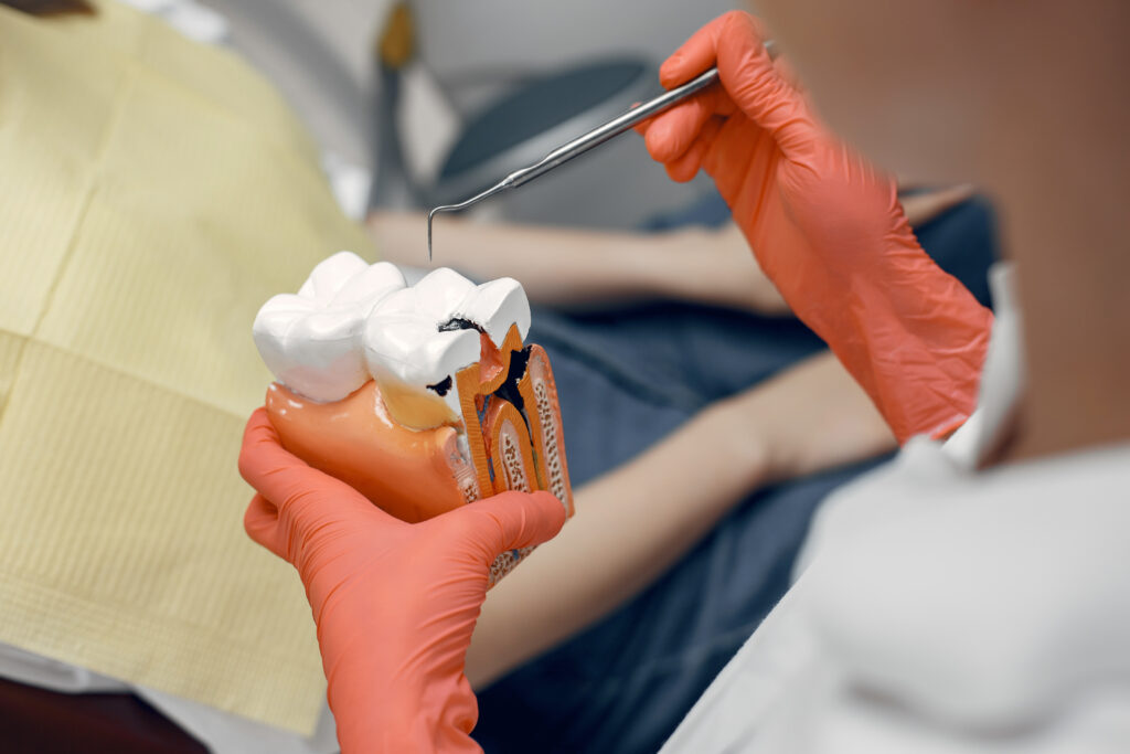 Questions To ask a Specialist About Pediatric Root Canals