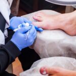 Recognizing the Symptoms of Ingrown Toenails