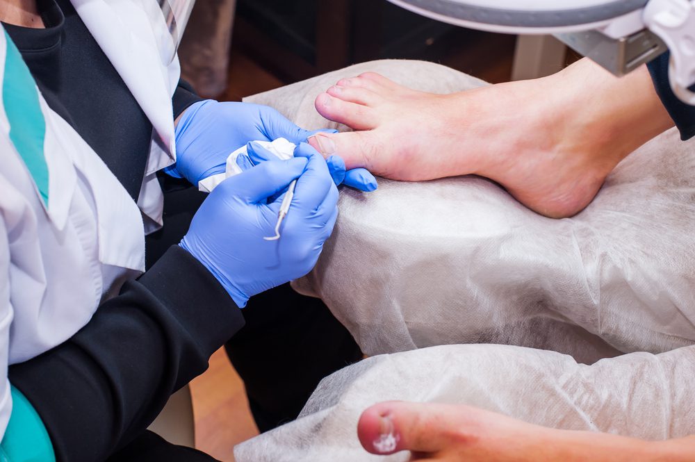 Recognizing the Symptoms of Ingrown Toenails