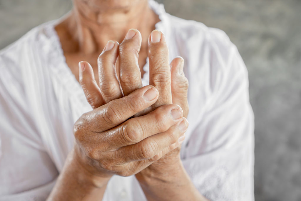 The Connection Between Aging and Arthritis