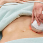 Who Benefits From Body Contouring?